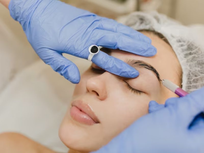 Non Surgical Procedure for Brow Lift