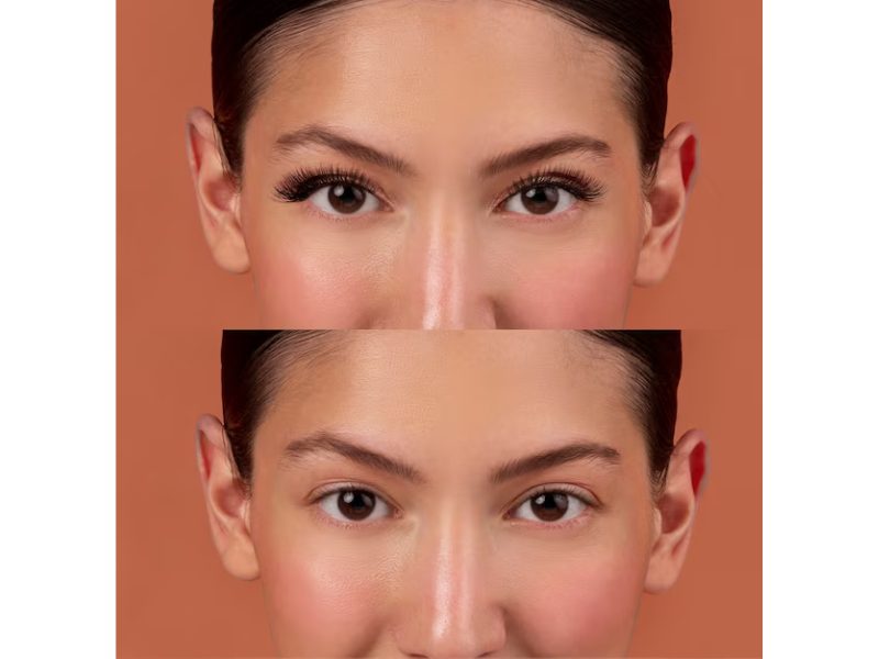 What Causes Different Types of Eyelids?