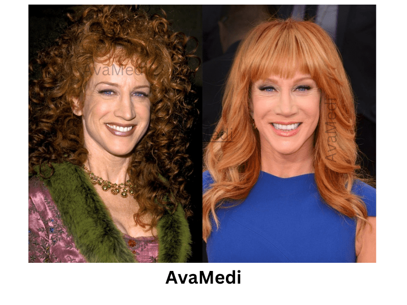 Kathy Griffin before and after nose job