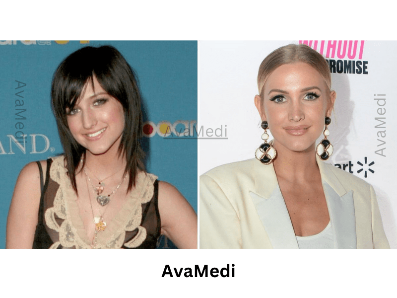 Ashlee Simpson Ross before and after nose job