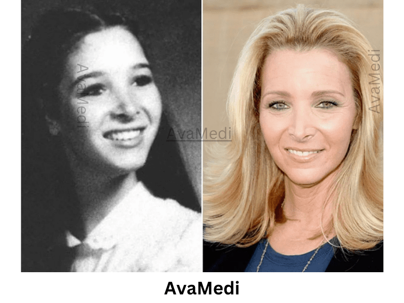 Lisa Kudrow before and after nose job