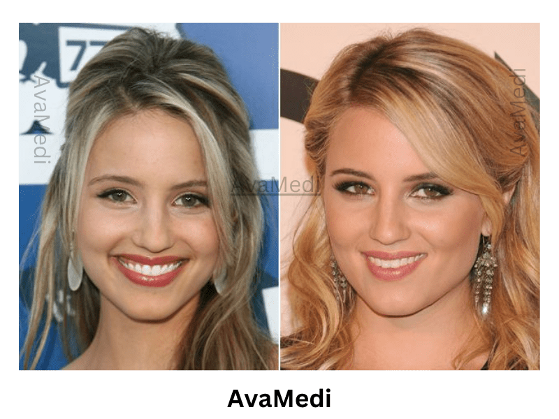 Dianna Agron before and after nose job