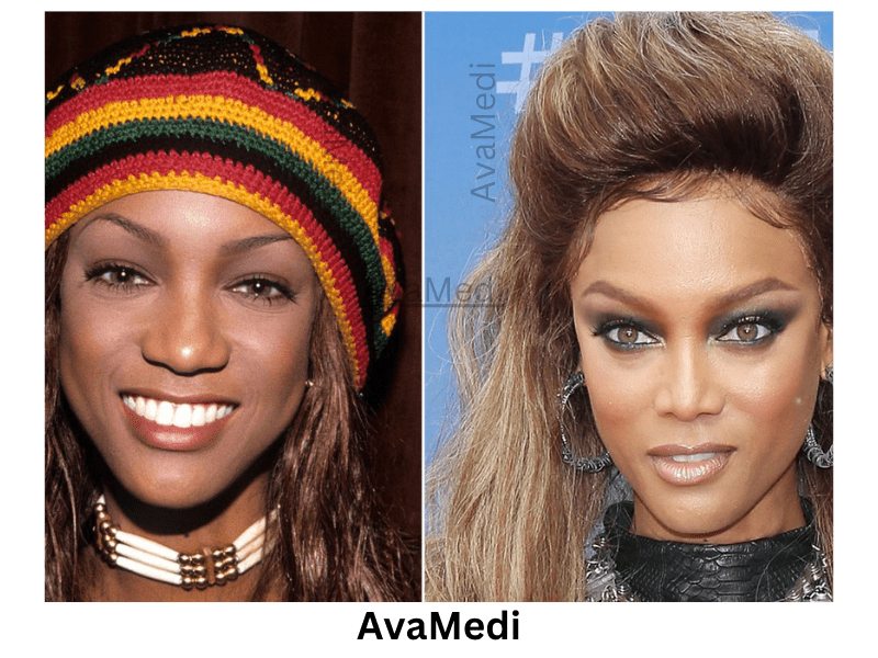 Tyra Banks before and after nose job