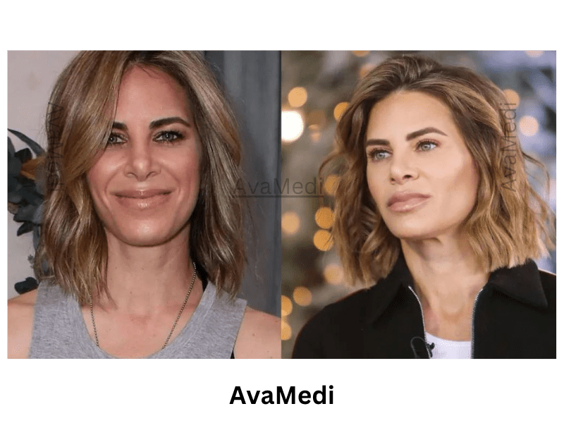 Jillian Michaels before and after nose job