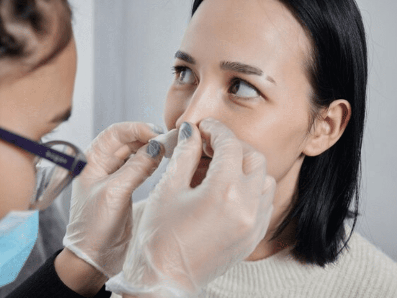 Some Solutions to Ease the Nasal Tip Surgery Recovery Time
