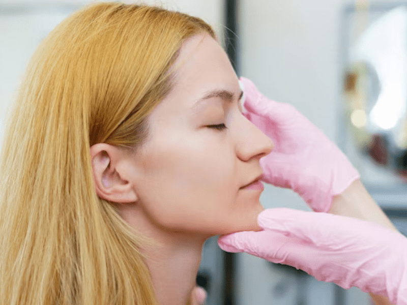 What is Different about Bulbous Nose Tip Rhinoplasty?